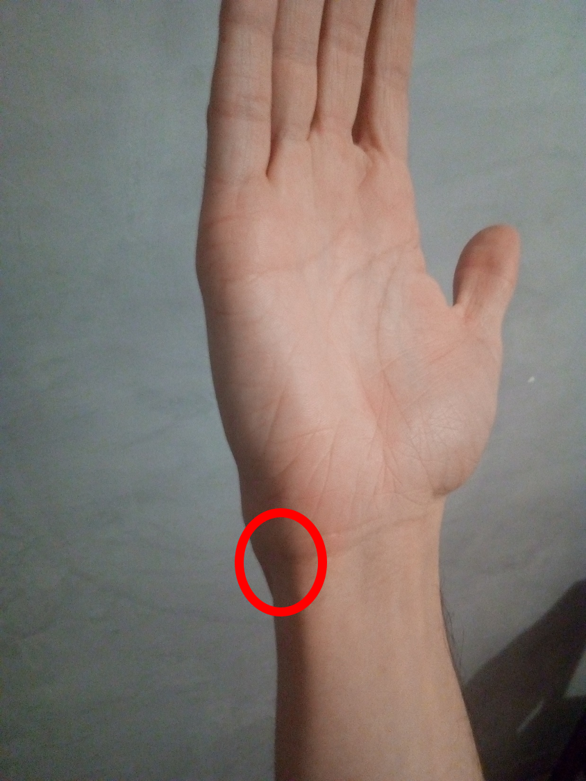 Douleur poignet droit (gaucher) - Infirmerie - Forum ...